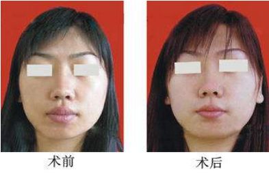 杭州哪家整形醫(yī)院口碑比較好，推薦浙江醫(yī)美排行榜前十佳