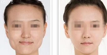 黑龍江三甲整形醫(yī)院熱門榜單，前三強大揭秘！