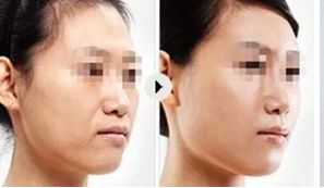 上海頂尖美容整形醫(yī)院精選，讓你真正了解排行榜