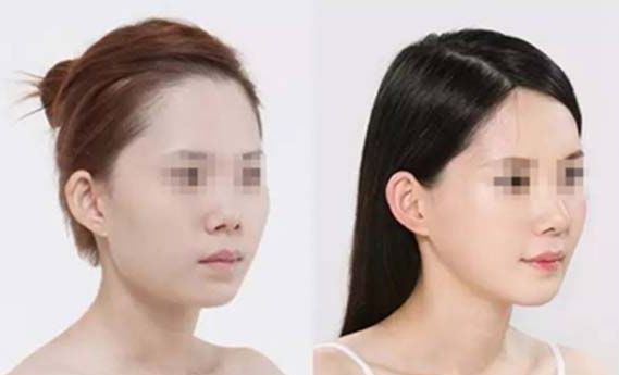 杭州雙眼皮專家推薦:排行榜前四強(qiáng)醫(yī)院評(píng)測(cè) 杭州雙眼皮專家推薦:排行榜前四強(qiáng)醫(yī)院評(píng)測(cè)