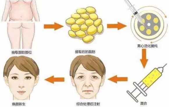 臺州哪家整形美容醫(yī)院效果好？