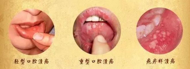 北京眼袋整形醫(yī)院排名大揭秘，最佳去眼袋選擇！
