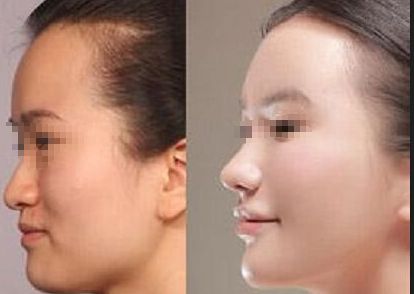 臨沂市醫(yī)美醫(yī)院排名及推薦，推薦你去哪家治療效果好