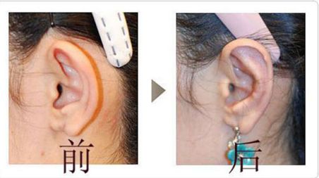 成都友誼醫(yī)院疤痕科：設(shè)備先進(jìn)、技術(shù)精湛，治療效果如何？