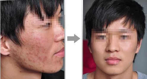 濟南高新麥昆醫(yī)療美容診所的價格如何？真實技術測評與大揭秘