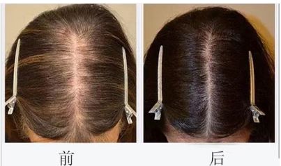 上海頦裂治療專科醫(yī)院排名出爐，這家醫(yī)院獲得認(rèn)可，其他哪些醫(yī)院也在其中？