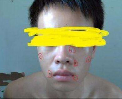 ?？谑笳吾t(yī)院匯總，哪家效果比較好？