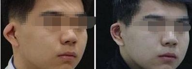 北京三甲隆胸醫(yī)院排名公布：哪家醫(yī)院技術(shù)過硬，值得信賴？