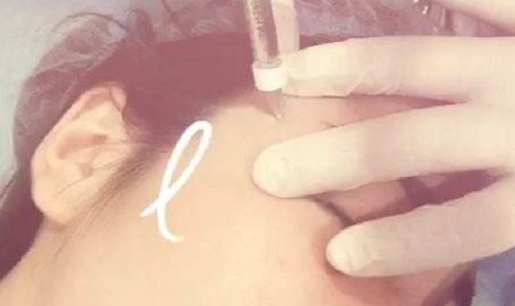 深圳前海地區(qū)哪家整形醫(yī)院比較靠譜？好的深圳整容醫(yī)院有哪些？
