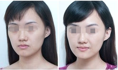 湖州唯美醫(yī)療美容門診部大眾口碑如何 湖州唯美醫(yī)療美容門診部大眾口碑如何