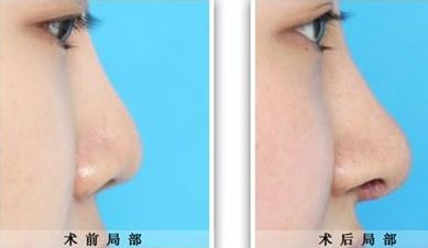 臨汾臻容醫(yī)療美容門診部詳解：技術(shù)水平、服務(wù)項目與價格清單