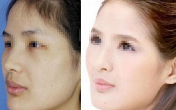 重慶美容整形科室推薦:挑選經(jīng)驗豐富的專家最重要 重慶美容整形科室推薦:挑選經(jīng)驗豐富的專家最重要