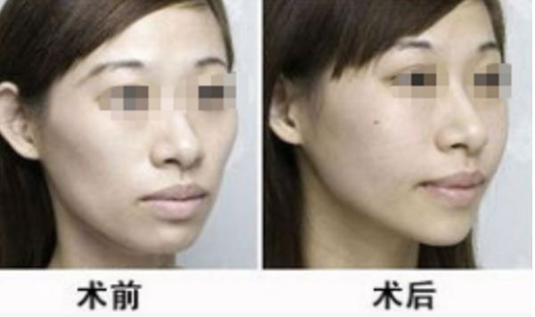 湖北地區(qū)整形醫(yī)院評(píng)選榜單，醫(yī)術(shù)高超排名靠前的醫(yī)療機(jī)構(gòu)