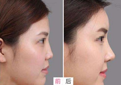 相山愛美爾醫(yī)療美容門診部，多項(xiàng)特色項(xiàng)目亮相，幫助您煥發(fā)美麗