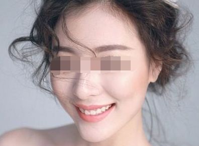 上海十大修復(fù)雙眼皮專(zhuān)家排行榜 上海十大修復(fù)雙眼皮專(zhuān)家排行榜