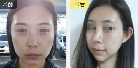 福州中聯(lián)美康醫(yī)療美容門診部的醫(yī)生技術(shù)及擅長項目推薦 福州中聯(lián)美康醫(yī)療美容門診部的醫(yī)生技術(shù)及擅長項目推薦