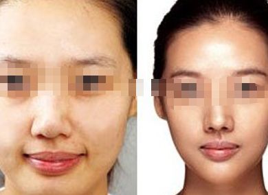 女星蠟像面容成災(zāi)，孫菲菲領(lǐng)銜瘦臉狂潮