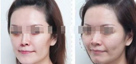 杭州整形美容醫(yī)院排名前六，你值得了解的每一家！
