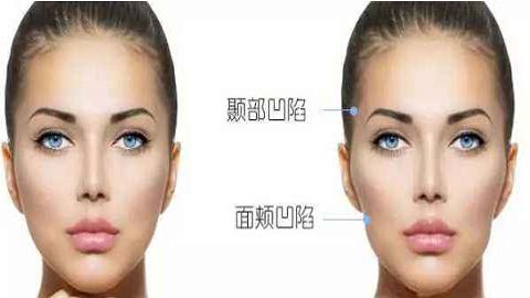 西安妃容醫(yī)療推薦的優(yōu)質(zhì)美容項(xiàng)目有哪些