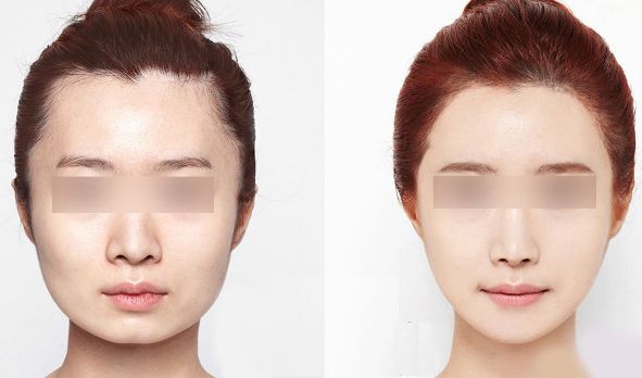 西安藝星醫(yī)療美容醫(yī)院2023年價格一覽：了解醫(yī)療美容服務(wù)費用信息，醫(yī)生簡介待查！
