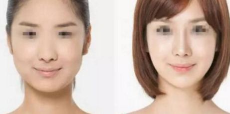 阜陽比較好的鼻子醫(yī)院在哪里 阜陽比較好的鼻子醫(yī)院在哪里