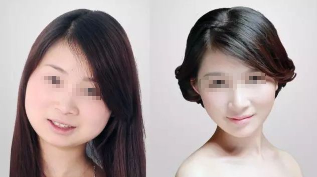 成都藝星何林：打造自然大方雙眼皮，3位顧客口碑爆棚