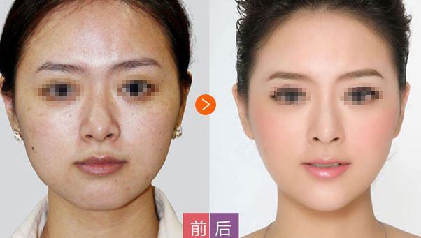 邢臺博愛高健整容致命嗎？高健整容水平值得信賴！