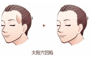 成都整形醫(yī)院排名前十名單整理，銅雀臺(tái)、米蘭柏羽何居首？