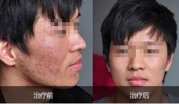 酒泉維爾麗整形醫(yī)院醫(yī)生團隊精湛技藝，專業(yè)特色項目讓您心動！