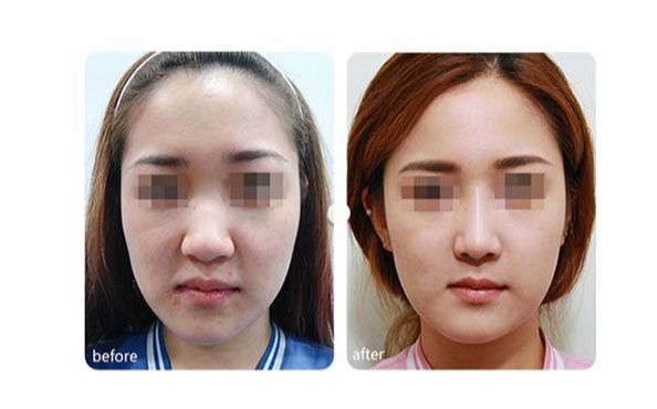 廣州優(yōu)質(zhì)磨骨整形醫(yī)院推薦！TOP10醫(yī)療機(jī)構(gòu)揭秘