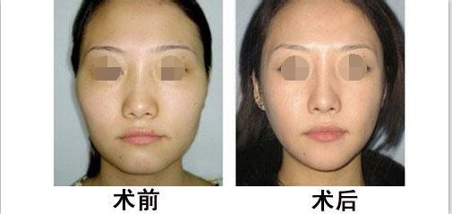 蘭州有哪些專業(yè)整形醫(yī)院值得去？