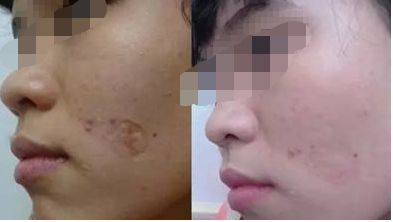無錫哪家醫(yī)院的美容效果好 無錫哪家醫(yī)院的美容效果好