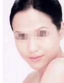 廣州哪家醫(yī)院吸脂做得好？看看排名前十的正規(guī)醫(yī)院