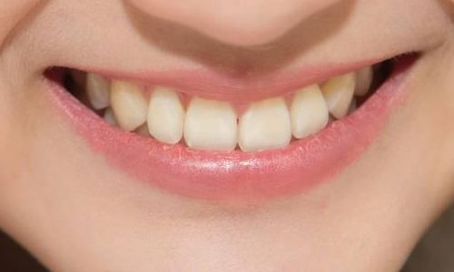深圳哪里可以做安全可靠的抽脂手術(shù)？