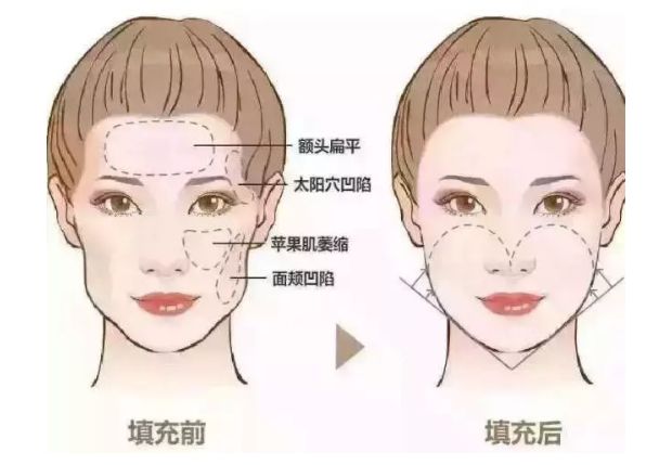 2024年廣州整形醫(yī)院熱門推薦，安全可靠有口碑！