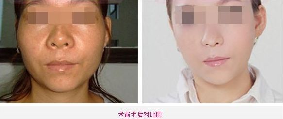 全新整容醫(yī)院推薦！這5家值得你關注