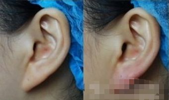湖州哪家醫(yī)院能有效提升面部外觀？