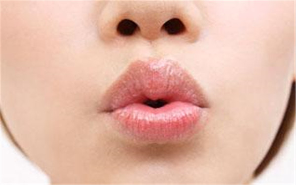 上海埋線(xiàn)雙眼皮失敗修復(fù)醫(yī)生