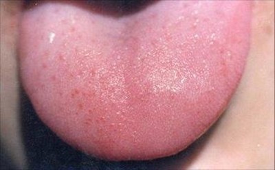 徐州自體細(xì)胞移植豐胸醫(yī)生