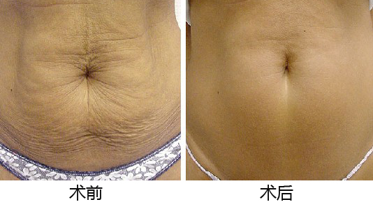 義烏整形醫(yī)院優(yōu)選TOP5，專業(yè)權(quán)威推薦，如何做出準(zhǔn)確選擇？深入了解為上策