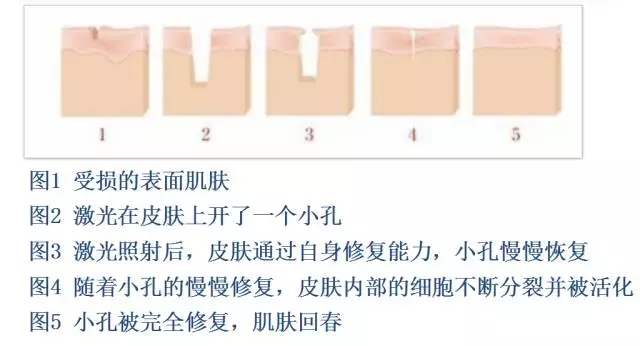 樂(lè)山整形美容院推薦！想在樂(lè)山做整形的話，這些建議不容錯(cuò)過(guò)！