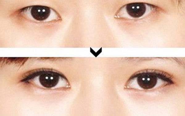 《青島哪家整形醫(yī)院的隆胸醫(yī)生口碑最好？匯總7位頂尖醫(yī)生！》
