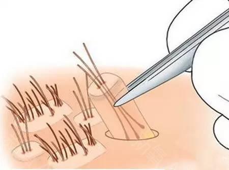全國著名植發(fā)醫(yī)院排行榜！推薦您前往上海九院、新生等頂級(jí)機(jī)構(gòu)