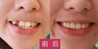 哪家醫(yī)院適合進(jìn)行磨骨手術(shù)？江城和美立方廣受網(wǎng)友推崇！