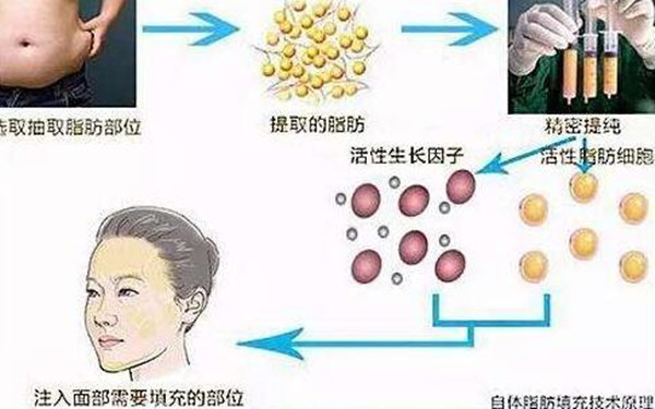 嘉興市頂級植發(fā)醫(yī)院推薦：五家實力強、口碑好，解決脫發(fā)難題的最佳選擇