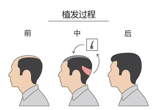 哈爾濱市排名靠前的整形醫(yī)院：公立與私立齊全，一定有一家適合您！