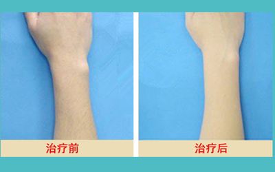最新發(fā)布！匯總?cè)箩t(yī)院名單，解決牙齒問題待了整整一年