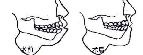 提供重慶哪家私立醫(yī)院割雙眼皮好？前五推薦_軍美領(lǐng)先，再揭秘
