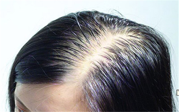 成都隆鼻醫(yī)院推薦【五大熱門(mén)選擇】 成都隆鼻醫(yī)院推薦【五大熱門(mén)選擇】