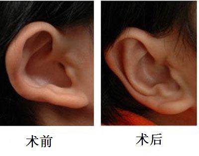 杭州口腔疾病治療首選！濃縮優(yōu)質(zhì)、平價口腔醫(yī)院一站攻略